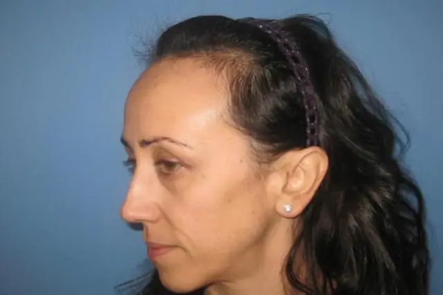 Как мне связаться с zesco?