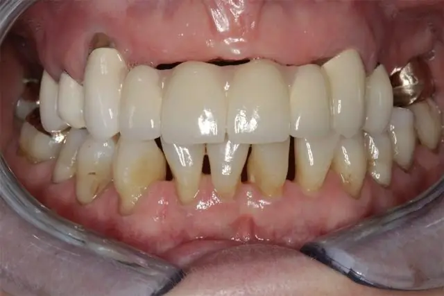 Какие зубы у белых медведей?