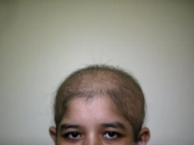 Изменяет ли гипотонический раствор форму клетки?