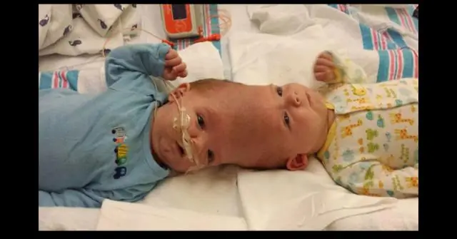 Является ли Кэл Кинг 2 близнецами?