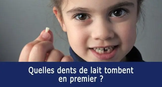 Комментарий tombent les dents de lait?