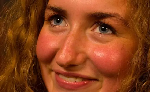 Почему у красных мангров есть опорные корни?