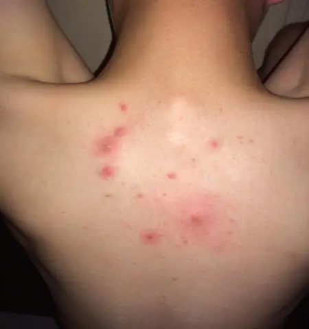 Как мне позвонить на австралийский мобильный телефон из Новой Зеландии?