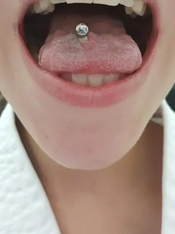 Что такое язычок?