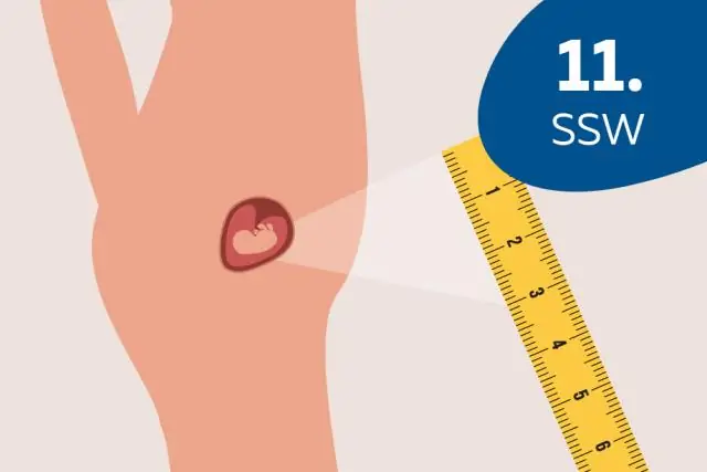 Какого размера гайка на шаровой опоре?