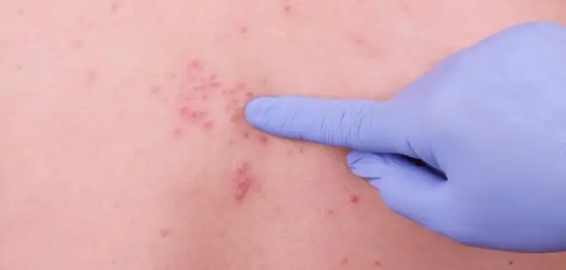 Сколько стоит пучок черепицы?