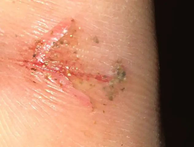 Как удалить песок с кожи?