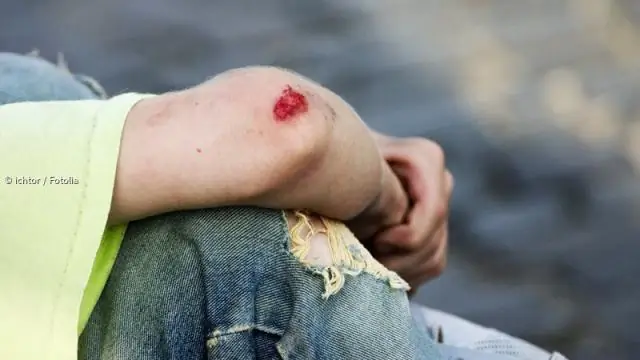 О профилактике спортивных травм