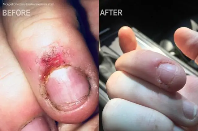 Через 15 дней решающими оказались 68 минут